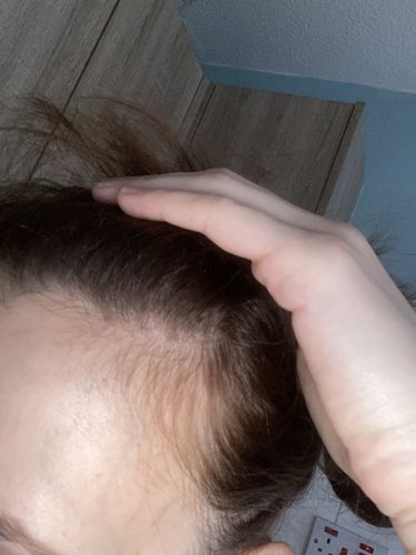 Customer photo review of Inches - Hair & Beard Oil