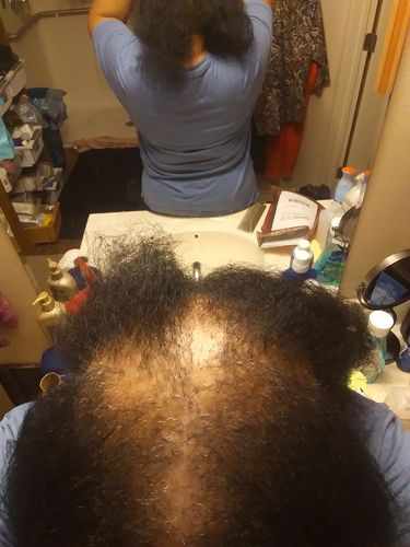 Customer photo review of BEST SELLER! | Chad and India’s Root to Tip Bundle| 3 sizes to choose from