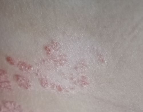 Customer photo review of Multi Strain Biotic