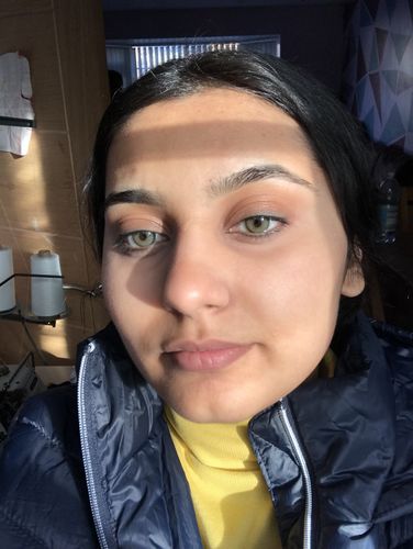 Customer photo review of Crystal Green Contact Lenses(12 months wear)