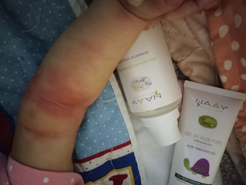 Customer photo review of Gel Aloe Vera Enriquecido