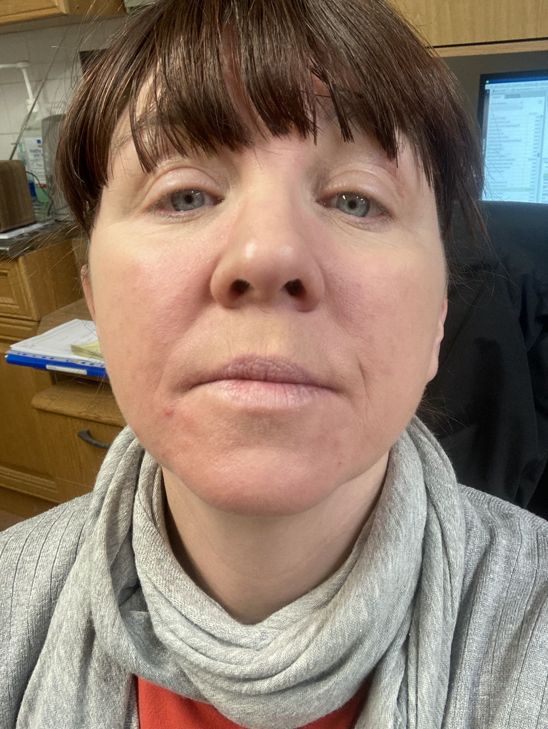 Customer photo review of Healing Miracle Cream