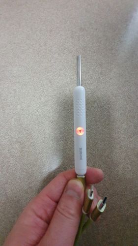 Customer photo review of Bebird™ Intelligent Earwax Removal Otoscope