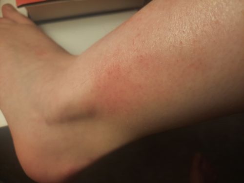 Customer photo review of Intensive Night Balm