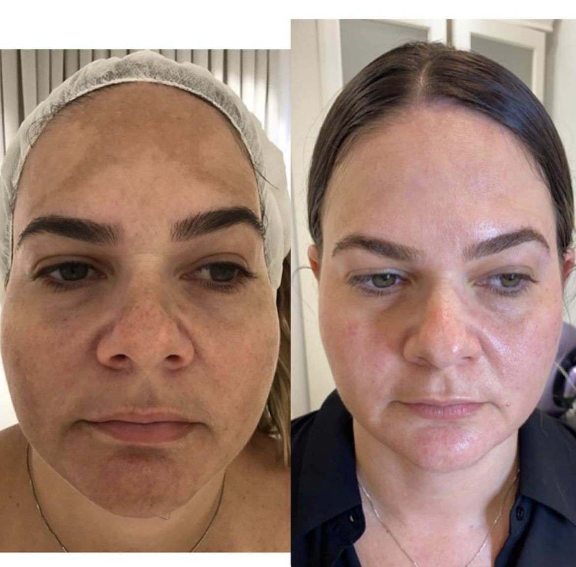 Avaliação com foto de um cliente sobre o DERMISONIC