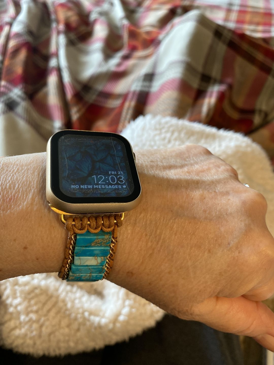 Customer photo review of Native Turquoise Protection Apple Watch Strap