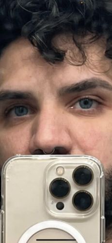 Customer photo review of Gem Blue Contact Lenses