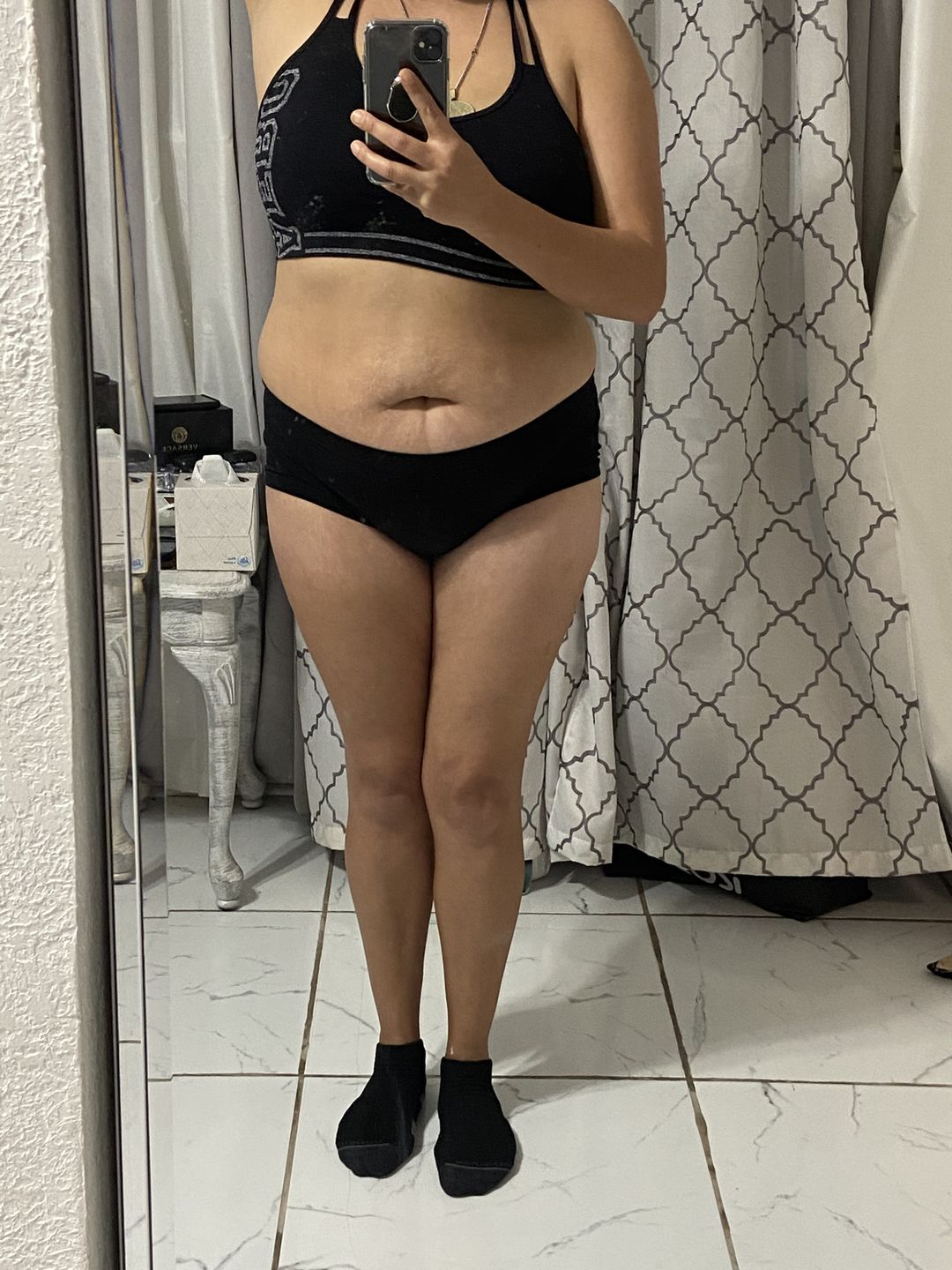 Customer photo review of Lipolimus Extracto de Alcachofa - Denova - Adelgazante y Anticelulítico