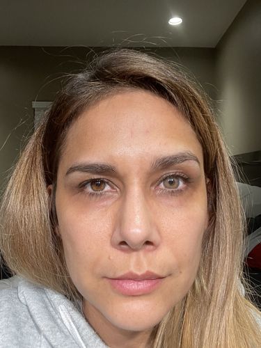 Customer photo review of [US Warehouse] Fantastic Beige Prescription Monthly Contact Lenses