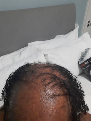 Customer photo review of Trio Set: African Black Soap Hair Growth Shampoo, Hair Growth Oil, and Hair Growth Conditioner