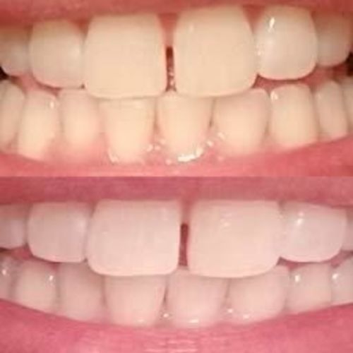 Customer photo review of Avec Moi Calm Comfort Brightening Toothpaste