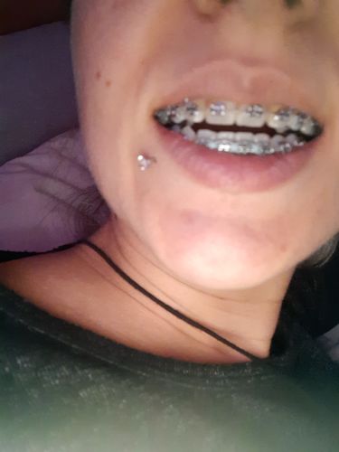 Customer photo review of GRATIS Pflegebundle