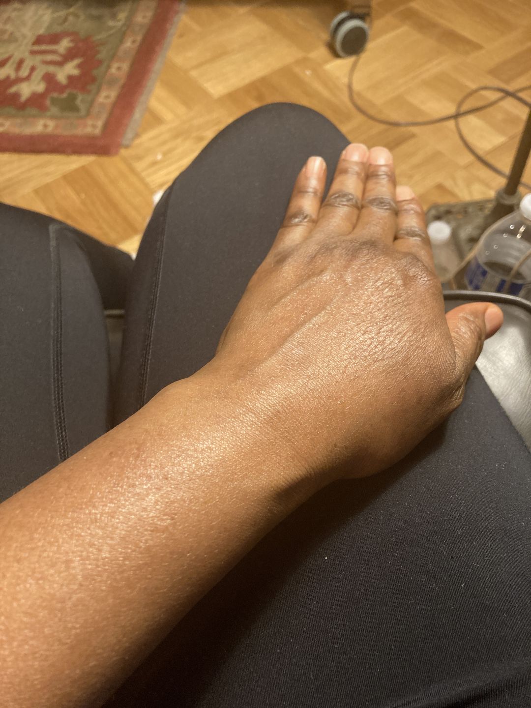 Customer photo review of Belle's Skin Body Oil