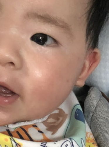 Customer photo review of Coco 濕疹修護霜 80ml