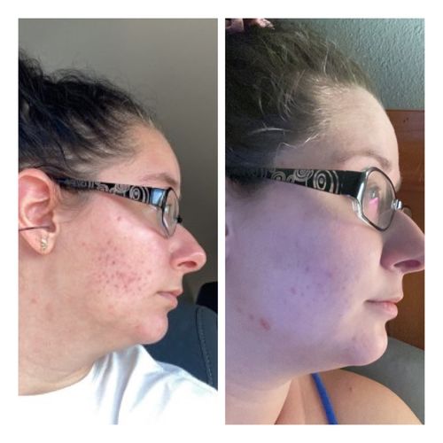 Jenna F. review of Qasil Powder for Hair and Skin, Organic Qasil Powder, Qasil Powder for Face, Pack of 1, 150gm image 1 out of 1