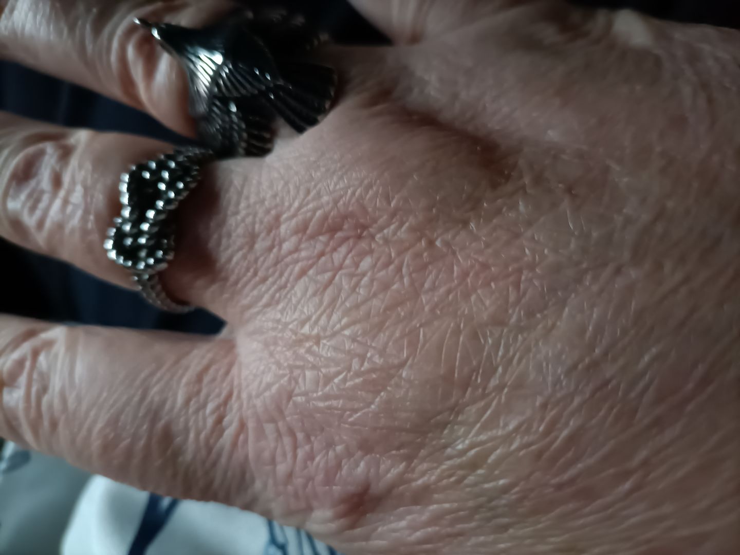 Customer photo review of FREEDOM. - SILVER
