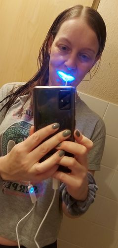 Customer photo review of PAP+ LED Teeth Whitening Kit