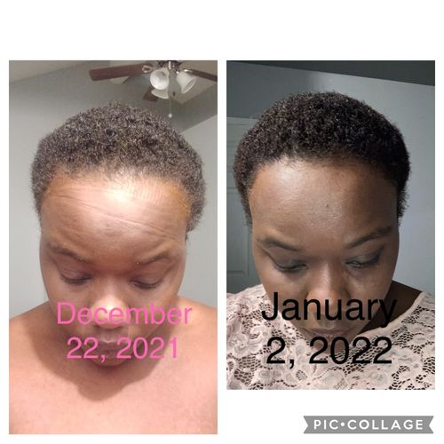 Customer photo review of Maximum Chebe Infused Hair Growth Oil