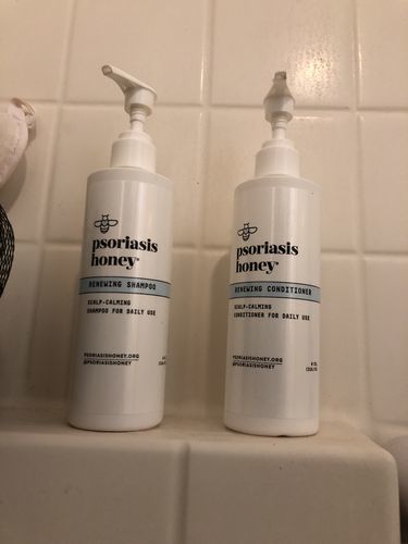 Customer photo review of Psoriasis Honey Scalp Nourishing Kit