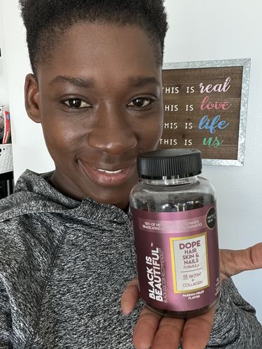 Customer photo review of Black Is Beautiful- Advanced Hair Skin & Nails Gummy (45 Day Supply/ .64 Cent A Day) CLICK HERE