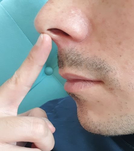 Customer photo review of RASURADORA DE NARIZ Y OREJAS - MyCOCOS® (VIP)