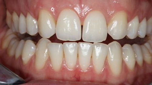 Customer photo review of GRATIS Pflegebundle