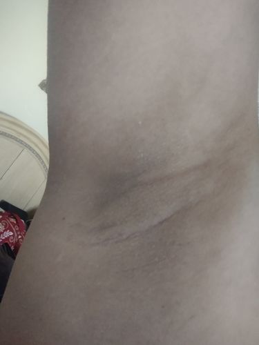 Customer photo review of Signature Series Hair Removal Wax