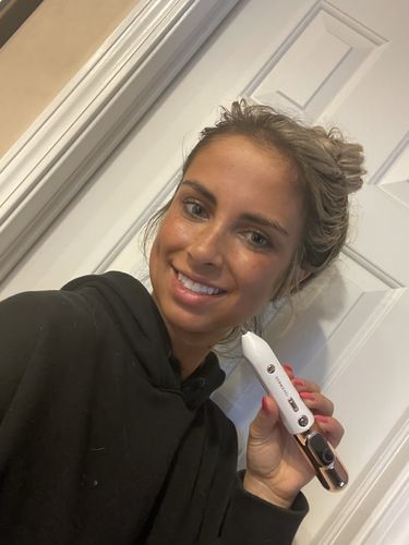 Customer photo review of Dermavel - Solo Kit