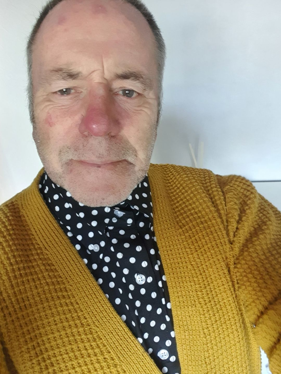 Customer photo review of Waffle Knit Cardigan - Mustard