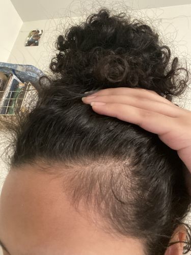 Customer photo review of Growth & Shine Hair Oil
