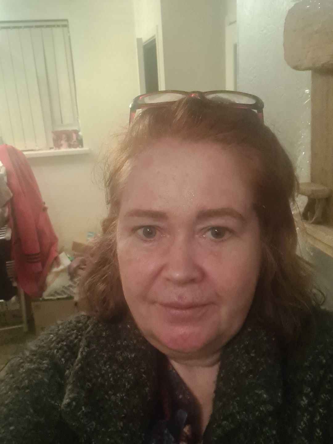 Customer photo review of Healing Miracle Cream