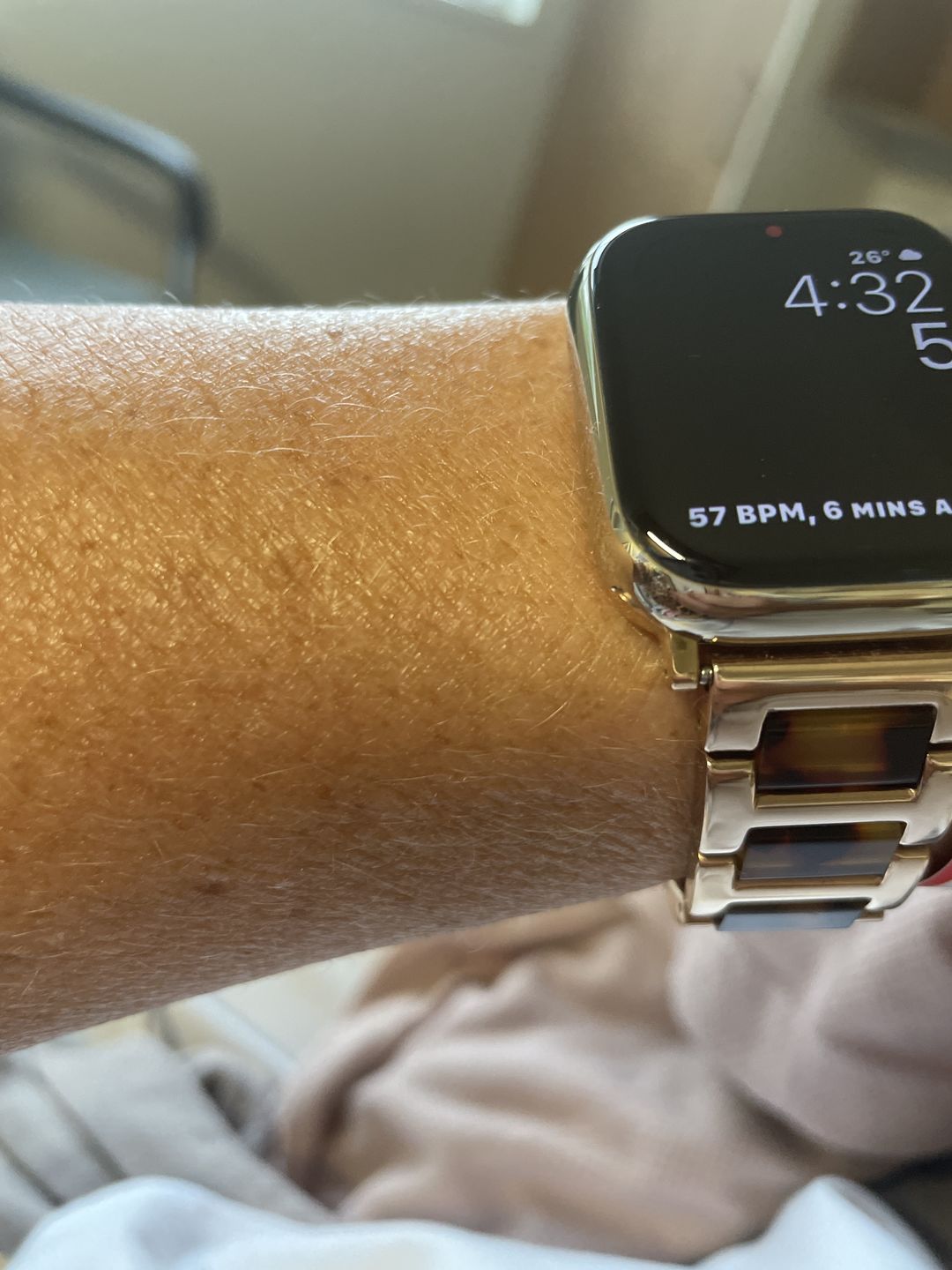 Customer photo review of Aura Metal Band (11 Colours)