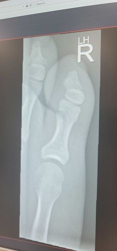 Customer photo review of Mixed 6-Pack