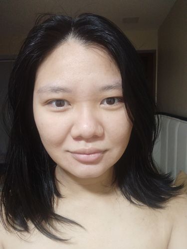 Customer photo review of Niacid