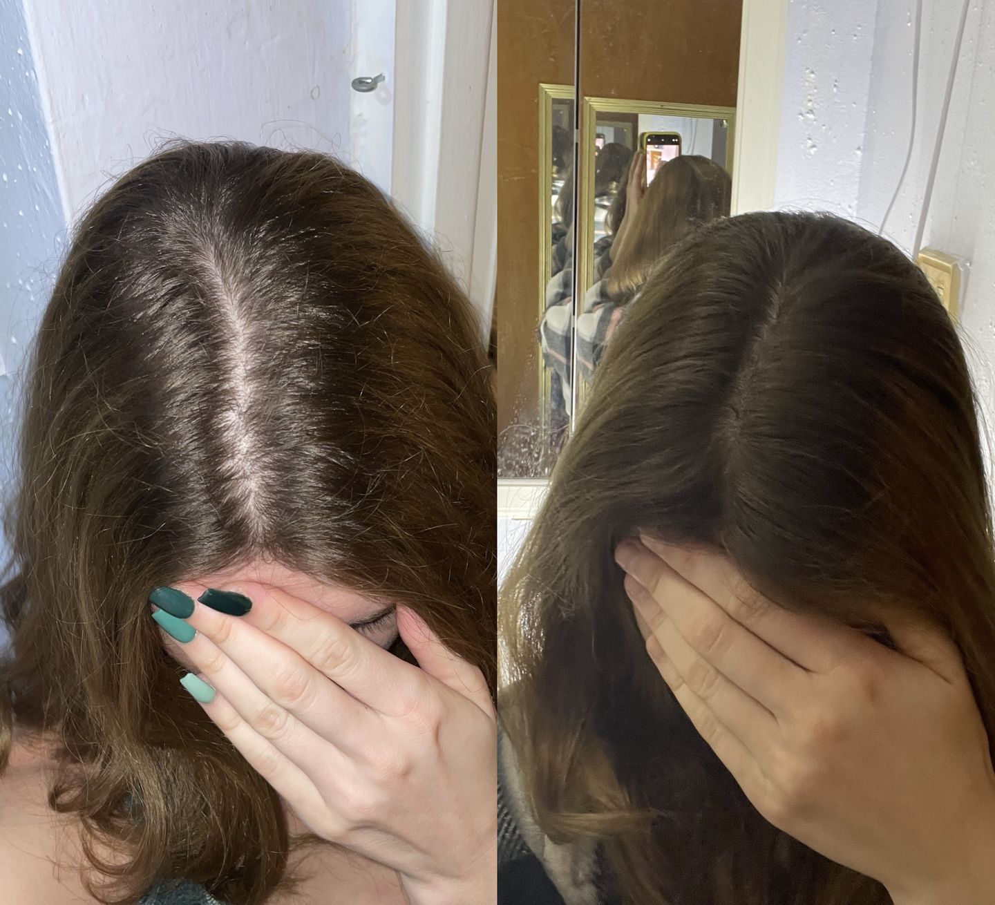 Customer photo review of HAIR GROWTH