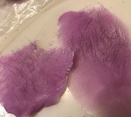Customer photo review of At-Home Signature Series Hair Removal Wax