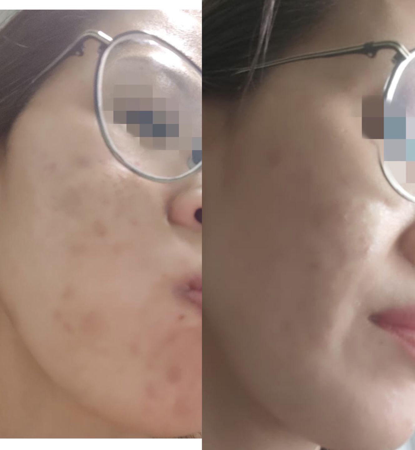 Customer photo review of CLEF Anti-Aging Cleansing Gel