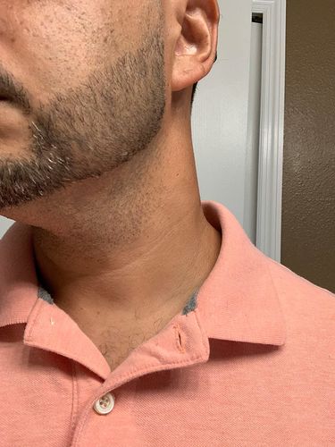 Customer photo review of LAVOSSY BEARD FILLER PENCIL