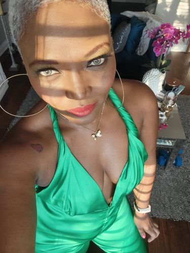 Customer photo review of Citha Hazel Contact Lenses(12 months wear)