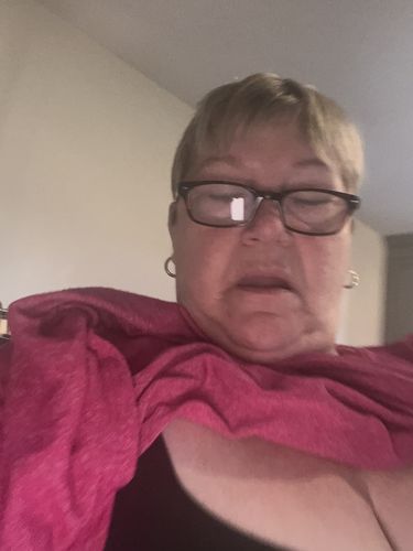 Customer photo review of Lily® Adjustable Chest Brace Front Closure Bras (3 PACK)