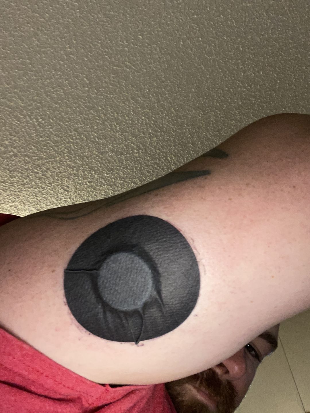 Customer photo review of Skin Grip MAX Freestyle Libre Patches