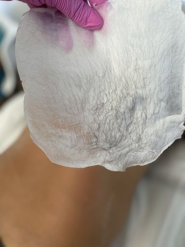 Customer photo review of Signature Series Hair Removal Wax