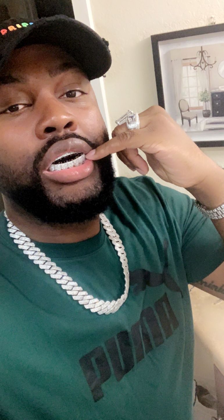 Customer photo review of 8 Tooth Standard Iced Grillz - White Gold
