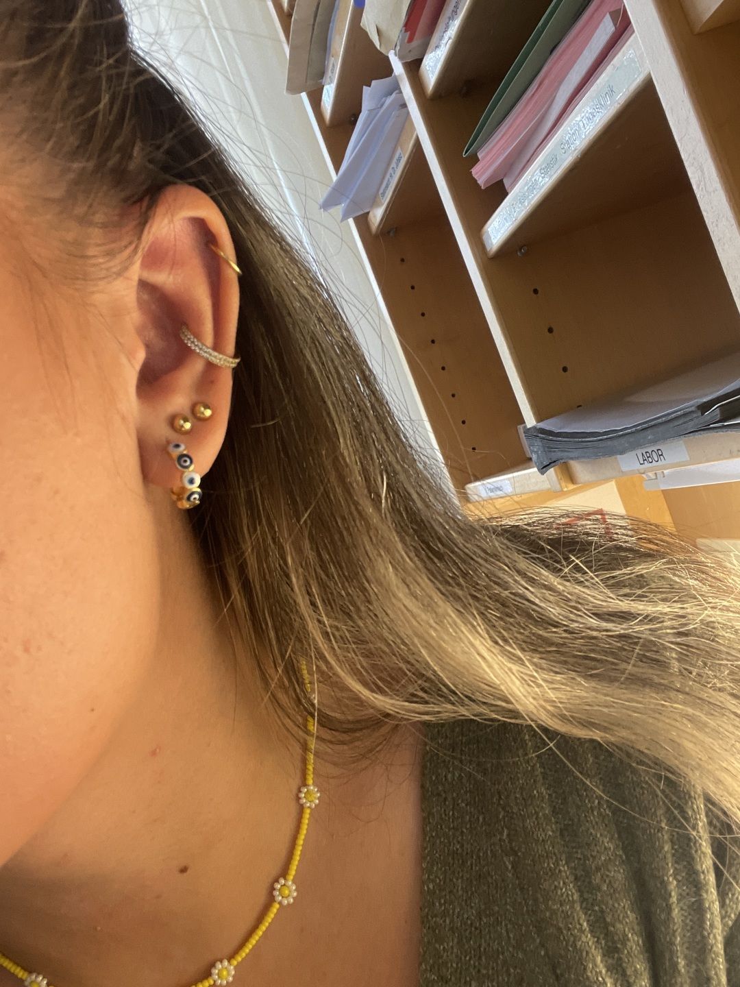 Customer photo review of Double Conch Piercing | Titan