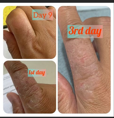Customer photo review of Jolicare Cream