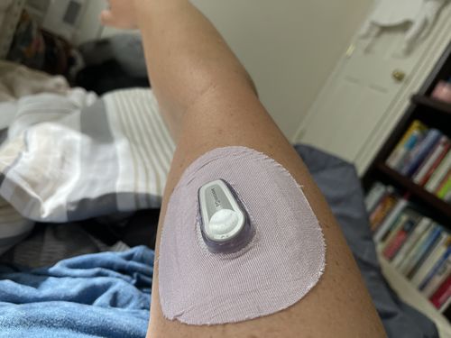 Customer photo review of Skin Grip Original - Dexcom G6 Patches