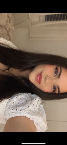 Customer photo review of Purple Rain Contact Lenses(12 months of use)