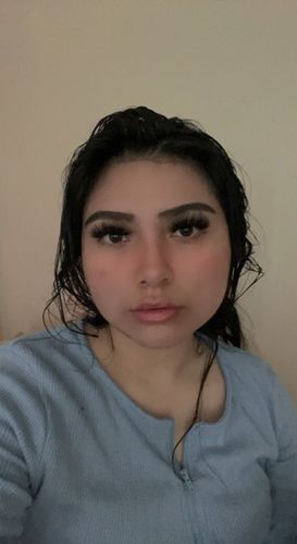 Customer photo review of LipFix: Filler