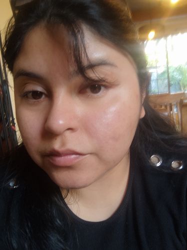 Customer photo review of Crema facial de Bardana para piel grasa