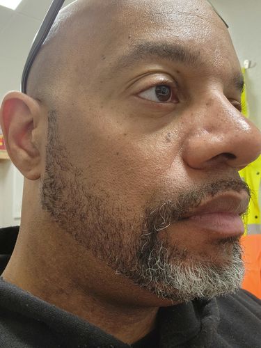 Customer photo review of Complete Beard Care Kit
